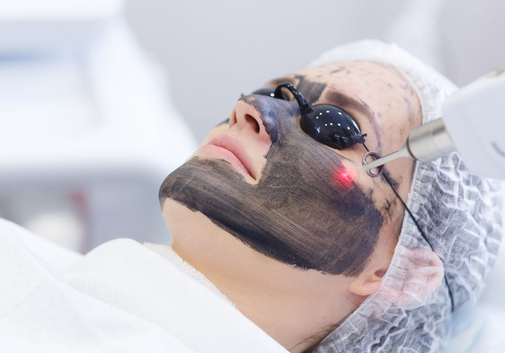 Carbon Facial